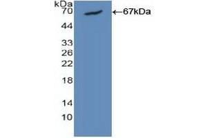 Detection of Recombinant CALM1, Human using Polyclonal Antibody to Calmodulin 1 (CALM1) (Calmodulin 1 anticorps  (AA 1-149))
