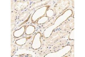 Immunohistochemistry analysis of paraffin-embedded human kidney using,THEA (ABIN7072933) at dilution of 1: 1600 (ACOT11 anticorps)