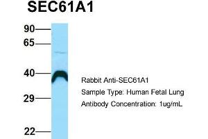 Host: Rabbit  Target Name: SEC61A1  Sample Tissue: Human Fetal Lung  Antibody Dilution: 1. (SEC61A1 anticorps  (C-Term))