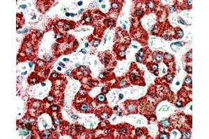 ABIN184850 (3. (Medium-Chain Specific Acyl-CoA Dehydrogenase, Mitochondrial (MCAD) (C-Term) anticorps)