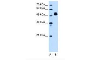 Image no. 1 for anti-ATP Synthase, H+ Transporting, Mitochondrial F1 Complex, beta Polypeptide (ATP5B) (C-Term) antibody (ABIN321396)