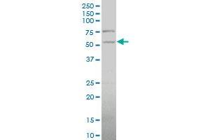 PDHX polyclonal antibody (A01), Lot # 051213JCO1 Western Blot analysis of PDHX expression in HepG2 . (PDHX anticorps  (AA 1-109))