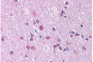 Human Brain, Cortex, White Matter (formalin-fixed, paraffin-embedded) stained with CLDN11 antibody ABIN214744 at 5 ug/ml followed by biotinylated goat anti-rabbit IgG secondary antibody ABIN481713, alkaline phosphatase-streptavidin and chromogen.