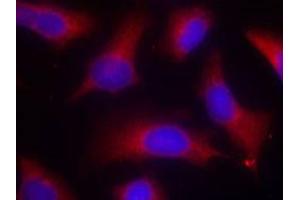 Immunofluorescent staining of methanol-fixed Hela cells using MAPT (phospho S262) polyclonal antibody  at 1:100-1:200 dilution.