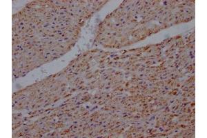 IHC image of ABIN7127865 diluted at 1:100 and staining in paraffin-embedded human heart tissue performed on a Leica BondTM system.