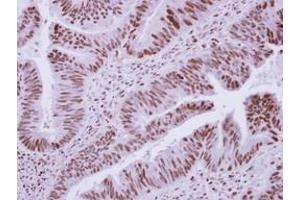 anti-Decapping Enzyme, Scavenger (DCPS) (AA 1-149) antibody