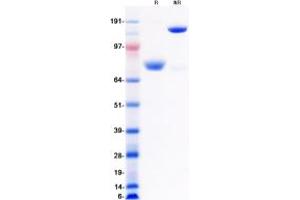Validation with Western Blot