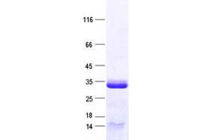 Validation with Western Blot
