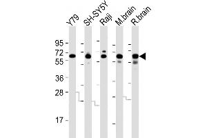 All lanes : Anti-DPYSL5 Antibody (C-term) at 1:2000 dilution Lane 1: Y79 whole cell lysates Lane 2: SH-SY5Y whole cell lysates Lane 3: Raji whole cell lysates Lane 4: mouse brain lysates Lane 5: rat brain lysates Lysates/proteins at 20 μg per lane. (DPYSL5 anticorps  (C-Term))