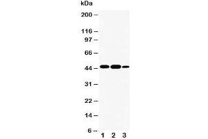 Western blot testing of INDOL1 antibody and Lane 1:  A549;  2: human placenta;  3: A431 cell lysate. (IDO2 anticorps  (AA 1-20))