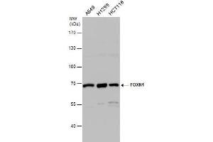 WB Image FOXN1 antibody [C3], C-term detects FOXN1 protein by western blot analysis.