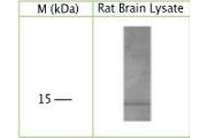 WB on rat brain lysate using Sheep antibody to human, rat, mouse GABA(A) receptor-associated protein (GABARAP, MM46, FLC3B): IgG at a concentration of 5 µg/ml under reducing condition.