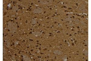 ABIN6261096 and ABIN6276787 at 1/100 staining Rat brain tissue by IHC-P. (CTNND1 anticorps  (C-Term))