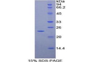 SDS-PAGE (SDS) image for Matrix Metallopeptidase 9 (Gelatinase B, 92kDa Gelatinase, 92kDa Type IV Collagenase) (MMP9) protein (ABIN1880145) (MMP 9 Protéine)