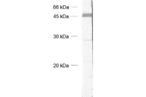 anti-BoNT antibody