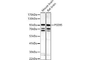 Western blot analysis of extracts of various cell lines, using PSD95 antibody (ABIN6134334, ABIN6139650, ABIN7101791 and ABIN7101792) at 1:500 dilution. (DLG4 anticorps  (AA 1-100))