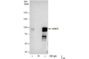 IP Image Immunoprecipitation of SOX13 protein from NT2D1 whole cell extracts using 5 μg of SOX13 antibody [N1C3], Western blot analysis was performed using SOX13 antibody [N1C3], EasyBlot anti-Rabbit IgG  was used as a secondary reagent. (SOX13 anticorps)