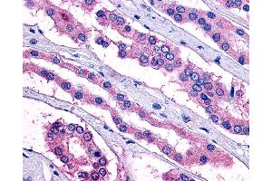 Anti-PTGER2 / EP2 antibody IHC of human kidney.