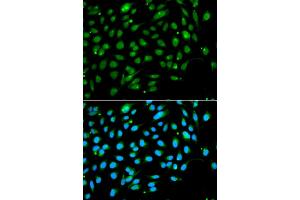 Immunofluorescence analysis of A549 cells using ING3 antibody. (ING3 anticorps)