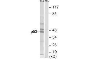 Western blot analysis of extracts from 293 cells, using p53 (Ab-378) antibody.