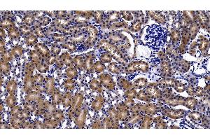 Detection of HIF2a in Mouse Kidney Tissue using Polyclonal Antibody to Hypoxia Inducible Factor 2 Alpha (HIF2a)
