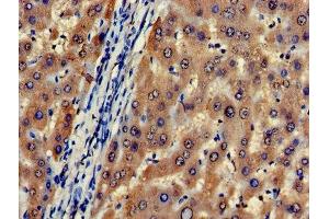 Immunohistochemistry of paraffin-embedded human liver tissue using ABIN7149082 at dilution of 1:100