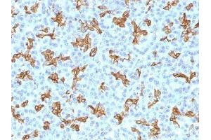 Image no. 1 for anti-Keratin 19 (KRT19) antibody (ABIN6172207) (Cytokeratin 19 anticorps)