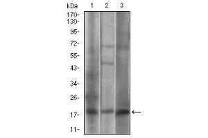Western blot analysis using CAV2 mouse mAb against A549 (1), 3T3-L1 (2), A431 (3) cell lysate. (Caveolin 2 anticorps  (AA 1-86))