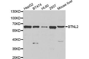 Western blot analysis of extracts of various cell lines, using BTNL2 antibody (ABIN5975278) at 1/1000 dilution. (BTNL2 anticorps)
