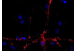 Indirect immunostaining of PFA fixed rat hippocampus neurons (dilution 1 : 500; red).
