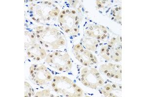 Immunohistochemistry of paraffin-embedded human stomach using THOC1 antibody at dilution of 1:100 (x40 lens). (THOC1 anticorps)