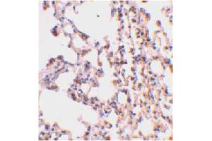 Immunohistochemical staining of mouse lung tissue using BID polyclonal antibody  at 2 ug/mL . (BID anticorps  (C-Term))