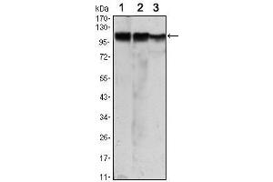 Western Blot showing HK2 antibody used against Jurkat (1), Hela (2) and HEK293 (3) cell lysate. (Hexokinase 2 anticorps)