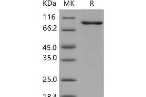 Western Blotting (WB) image for Checkpoint Kinase 2 (CHEK2) protein (GST tag,His tag) (ABIN7320011) (CHEK2 Protein (GST tag,His tag))