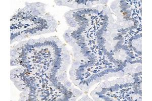 ABIN6263604 and ABIN6272967 at 1/100 staining Rat colon tissue by IHC-P. (Sialidase 4 anticorps  (Internal Region))