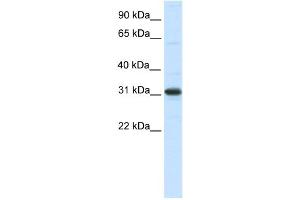 WB Suggested Anti-NRIP2 Antibody Titration:  0. (NRIP2 anticorps  (N-Term))