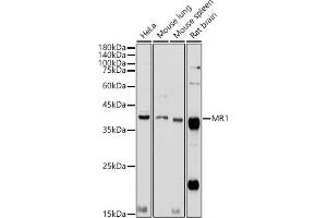 Western blot analysis of extracts of various cell lines, using MR1 antibody (ABIN6131925, ABIN6143983, ABIN6143984 and ABIN6224070) at 1:1000 dilution.