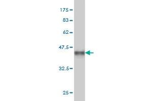 Western Blot detection against Immunogen (35. (CDK8 anticorps  (AA 375-464))