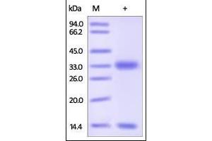 Cynomolgus / Rhesus macaque FcRn / FCGRT & B2M on SDS-PAGE under reducing (R) condition.