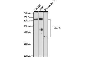 anti-F-Box Protein 25 (FBXO25) (AA 142-291) antibody