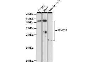 Western blot analysis of extracts of various cell lines, using FBXO25 antibody (ABIN7267087) at 1:1000 dilution. (FBXO25 anticorps  (AA 142-291))