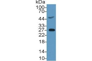Mouse Capture antibody from the kit in WB with Positive Control: Sample Rat Serum.