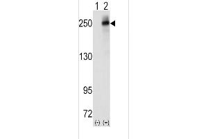 Western blot analysis of ALK(Center)(arrow) using rabbit polyclonal ALK(Center) Antibody (ABIN6243477 and ABIN6579002).