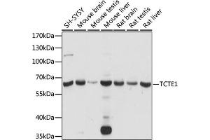 Western blot analysis of extracts of various cell lines, using TCTE1 antibody (ABIN7270710) at 1:1000 dilution. (TCTE1 anticorps  (AA 1-300))