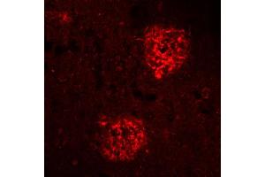 Immunohistochemistry (IHC) image for anti-Amyloid beta 1-40 (Abeta 1-40) antibody (ABIN1742442) (Abeta 1-40 anticorps)