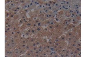 Detection of MAP3K1 in Human Liver Tissue using Polyclonal Antibody to Mitogen Activated Protein Kinase Kinase Kinase 1 (MAP3K1) (MAP3K1 anticorps  (AA 1307-1509))