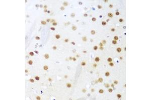 Immunohistochemistry of paraffin-embedded mouse brain using UNG antibody (ABIN5974439) at dilution of 1/100 (40x lens). (UNG anticorps)