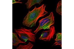 Image no. 7 for anti-ATP Citrate Lyase (ACLY) antibody (ABIN1491378) (ACLY anticorps)