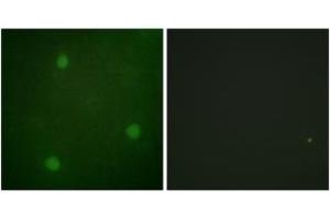 Immunofluorescence analysis of NIH-3T3 cells, using Artemis (Ab-516) Antibody.