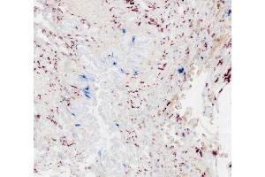 Frozen human lung tissue section was stained with anti-DC-SIGN followed by an AP conjugated secondary antibody and New Fucshin. (Chèvre anti-Souris IgG1 (Heavy Chain) Anticorps (Biotin))